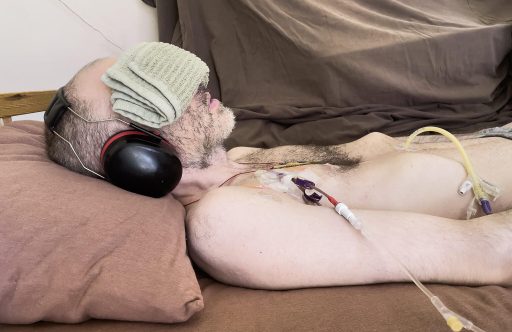 The image shows Whitney laying in a bed on a brown pillow with a towel over his eyes. On the right side of his chest, he has a medical tube attached.